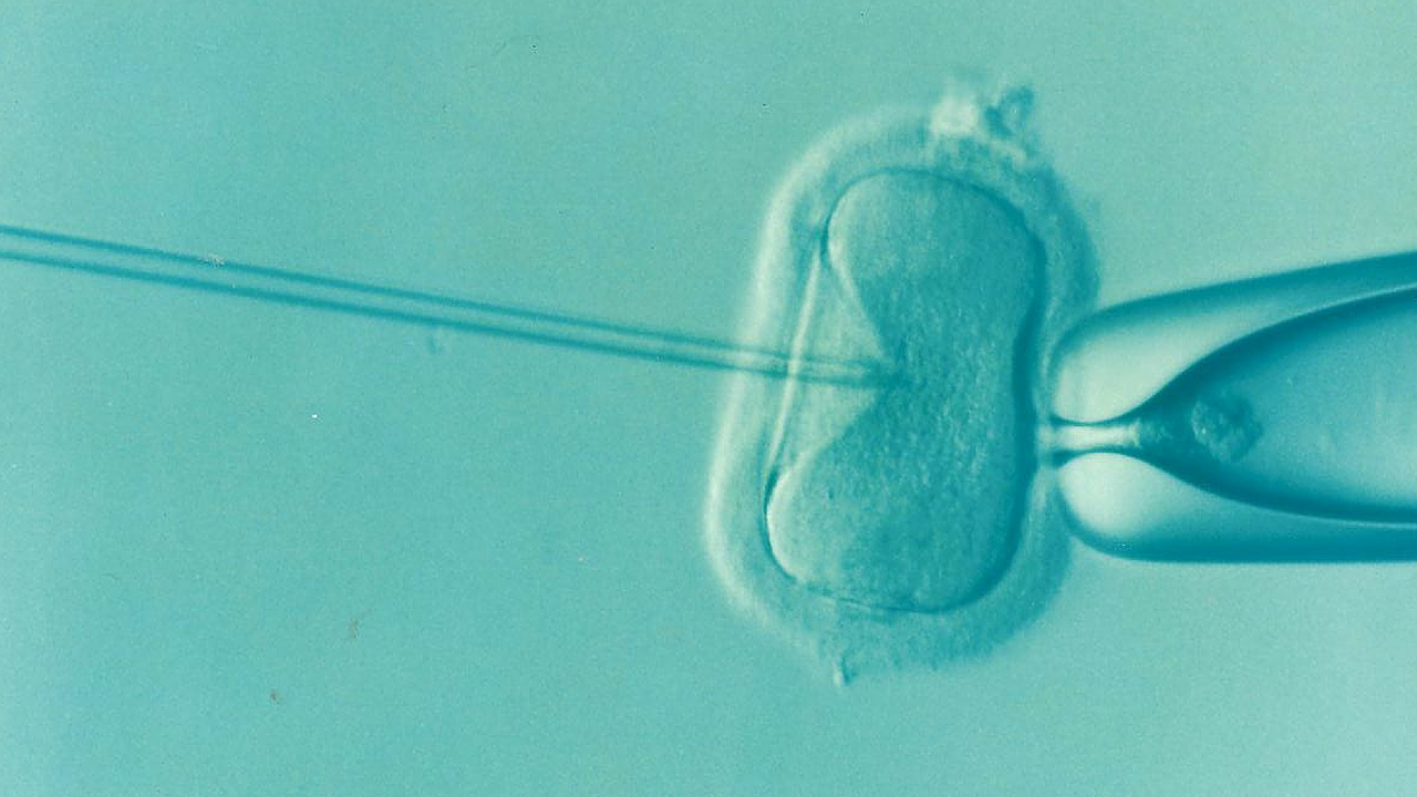 ucla-infertility-miscarriage-study