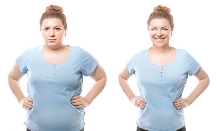 Why Are Overweight Women Being Unfairly Denied IVF? Why Are Overweight Women Being Unfairly Denied IVF?
