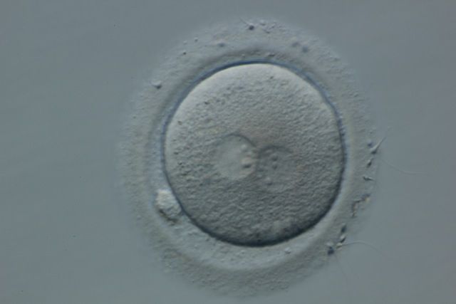 Day 1: A fertilized egg (2PN embryo)