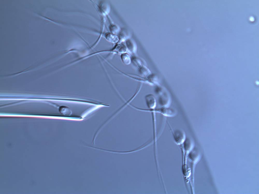 How does sperm quality affect pregnancy?