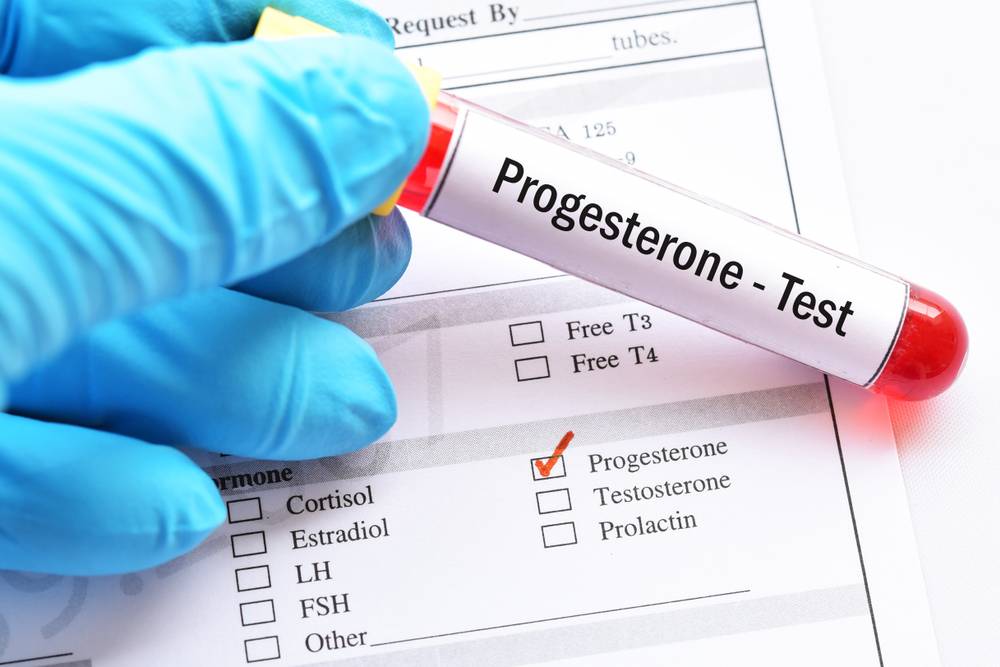 Low progesterone and the luteal phase deficiency