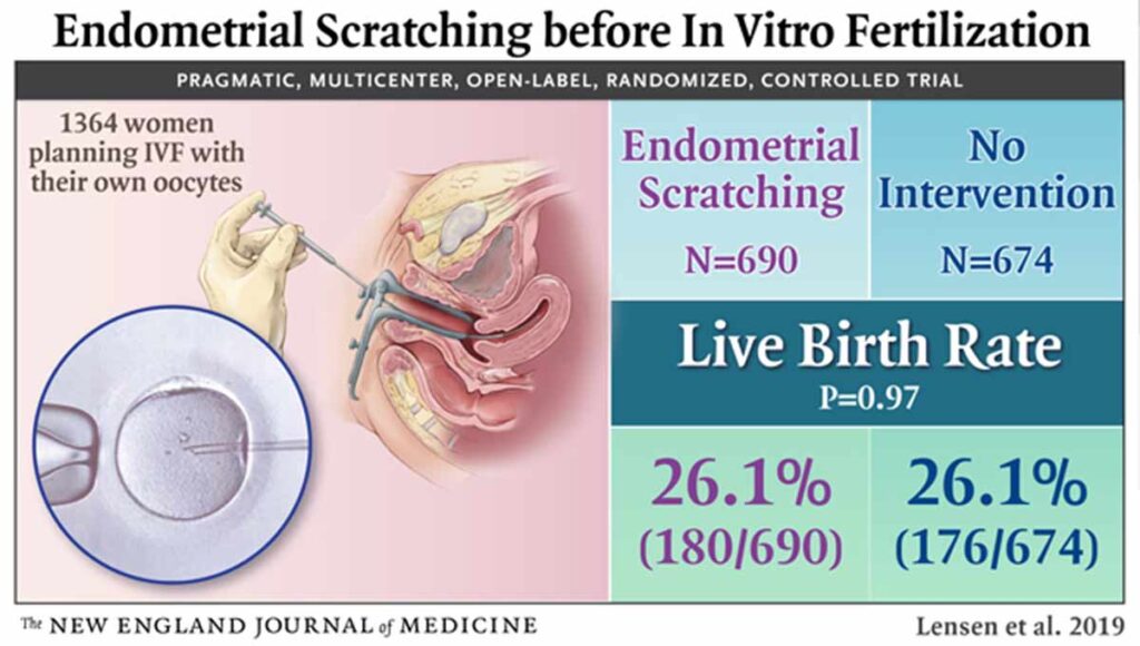 the use of Endometrial Scratch in IVF