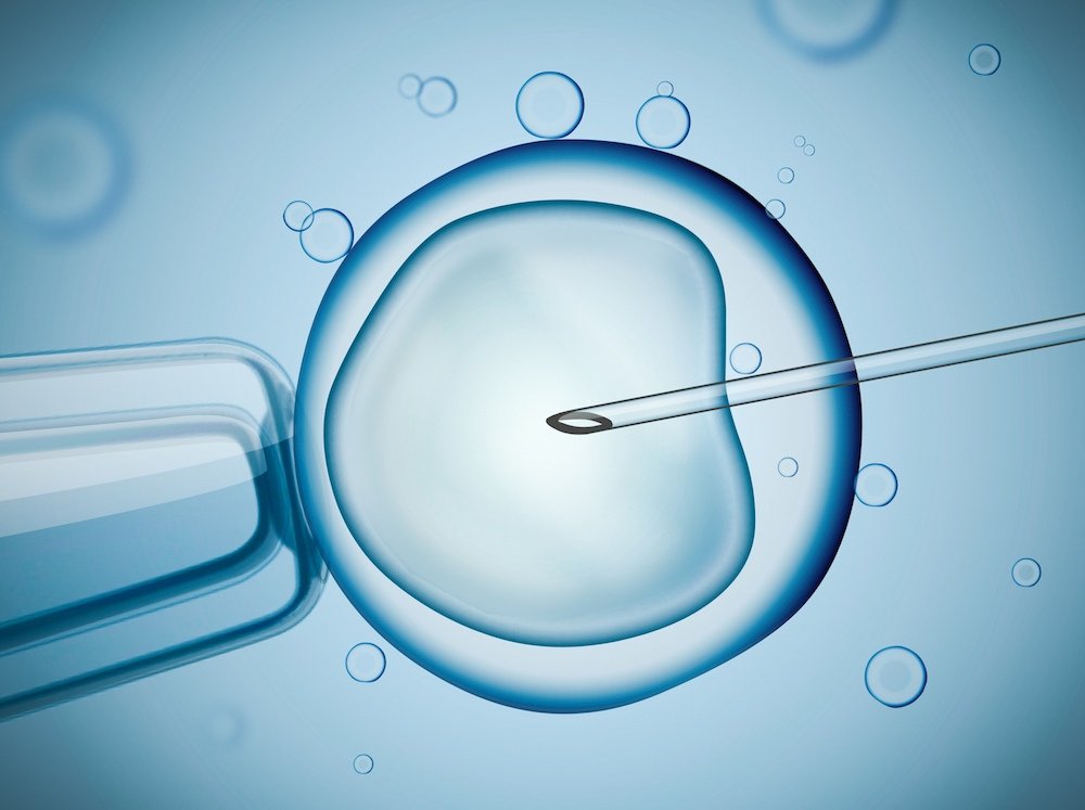 Latest figures from UK Fertility Regulator reveals how people are using IVF with a rise in female same-sex patients