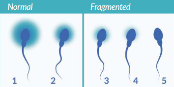 The Genetic Quality Of Sperm 4
