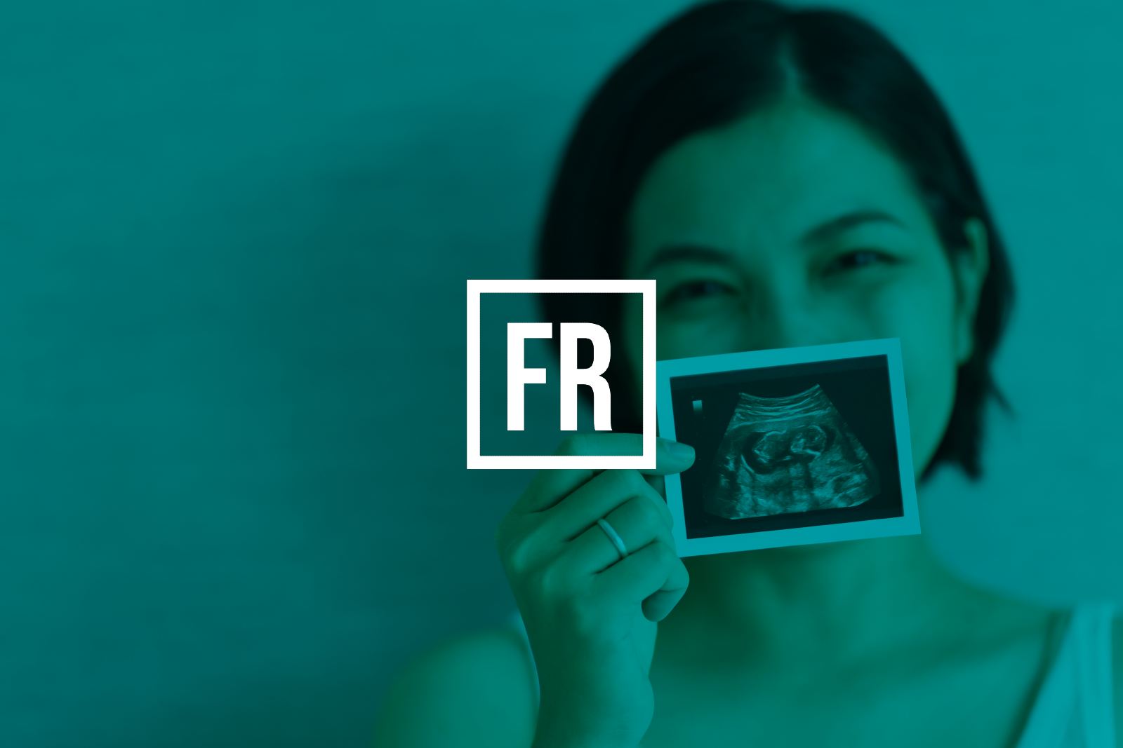 Mild Stimulation IVF And Natural Cycle IVF Fertility Road