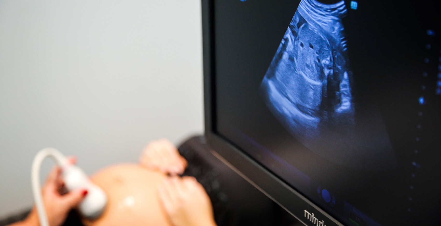 Ultrasound scan at Northway Clinic
