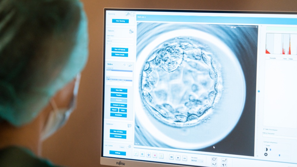 EmbryoScope at NatuVitro