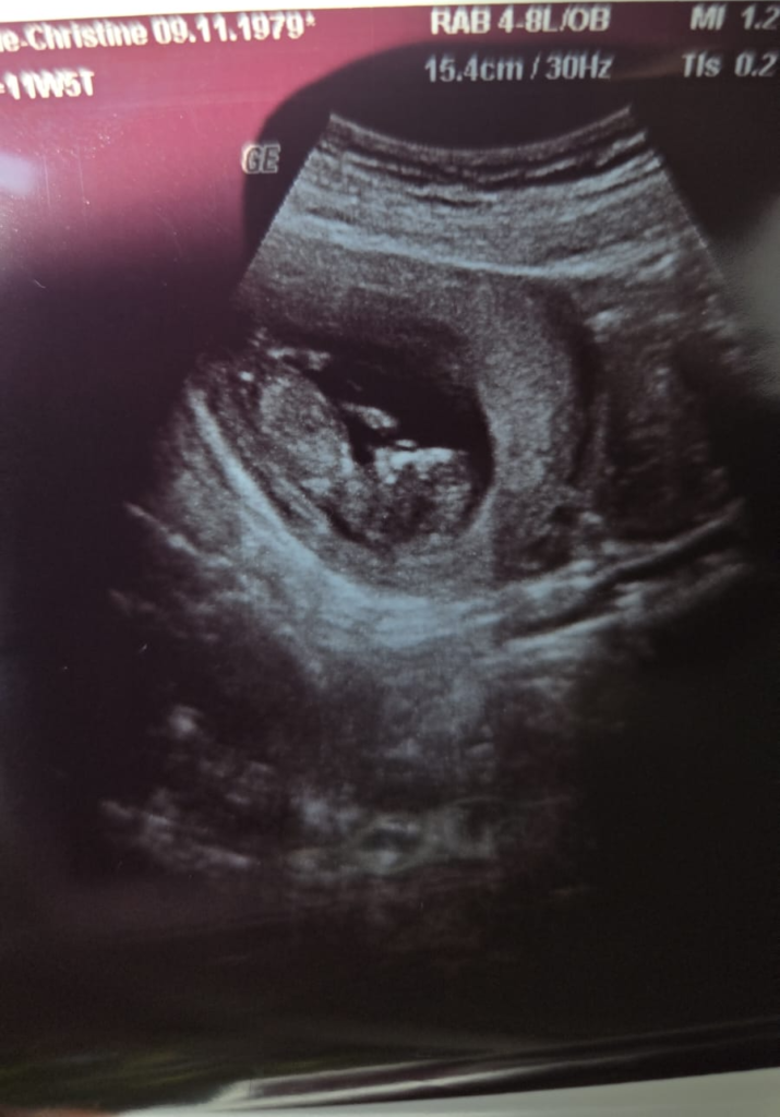 Marie enters second trimester with a burgeoning baby dump 7 Marie enters second trimester with a burgeoning baby dump 6